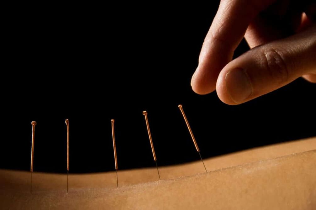 akupunktura pro prostatitidu