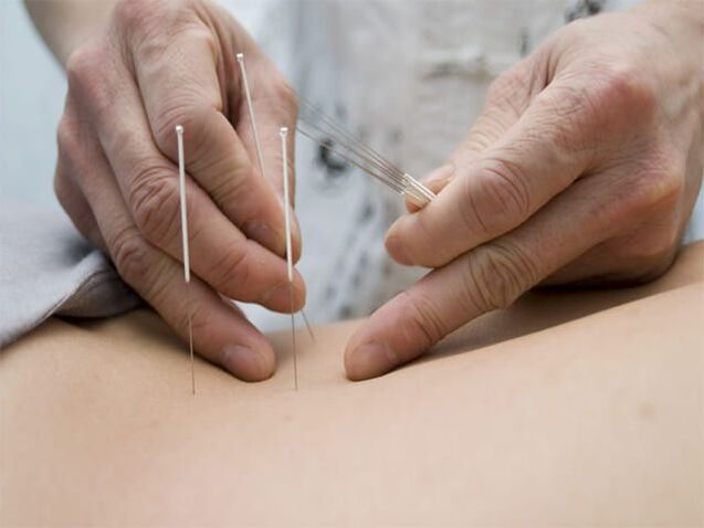 akupunktura pro prostatitidu